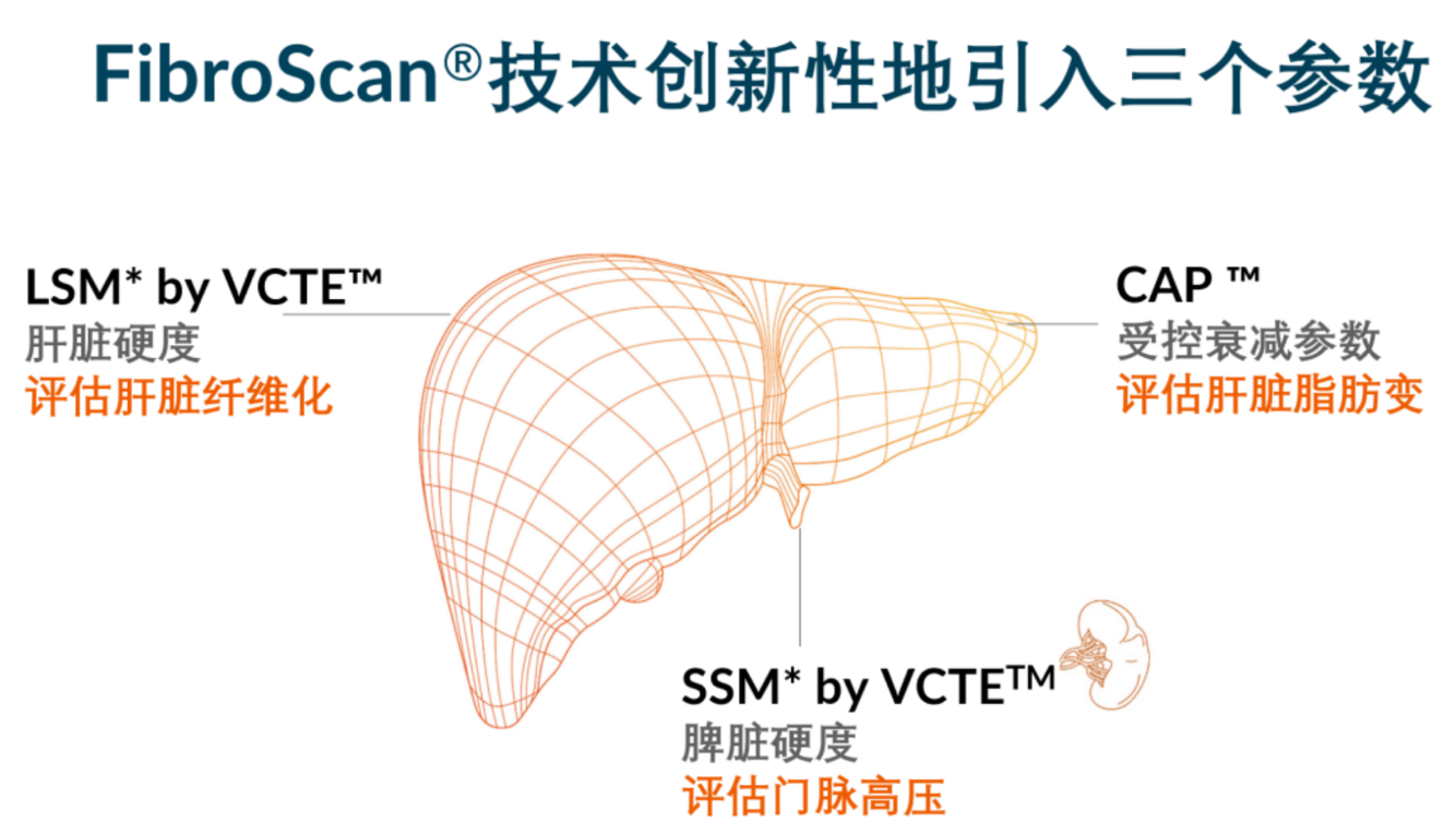 喜訊！FDA擴(kuò)大了FibroScan?在肝臟綜合管理中的應(yīng)用范圍